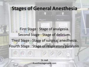 Stages of general anesthesia
