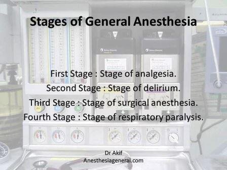 Stages Of Anesthesia Chart