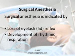 Surgical anesthesia and general anesthesia for surgery